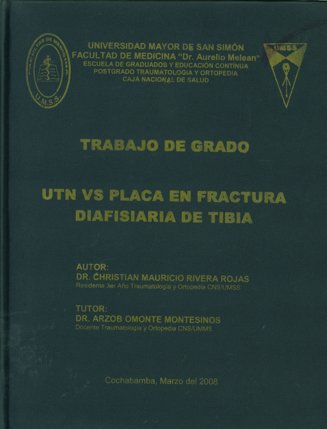 Utn Vs Placa en Fractura Diafisaria de Tibia
