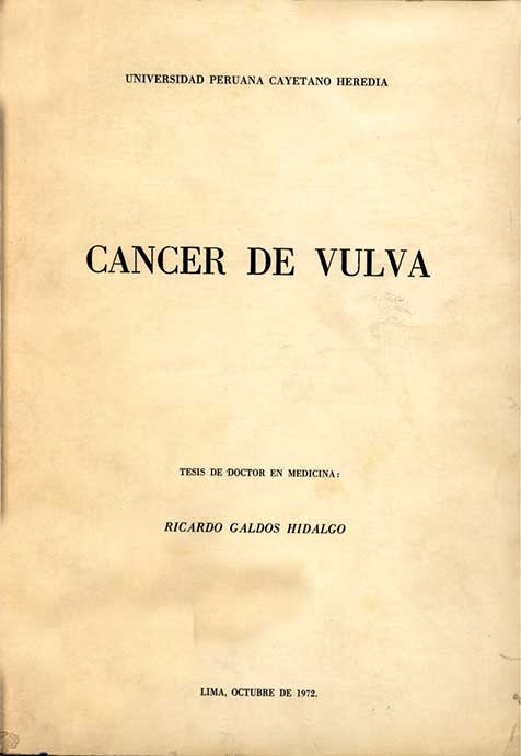 Cancer de vulva